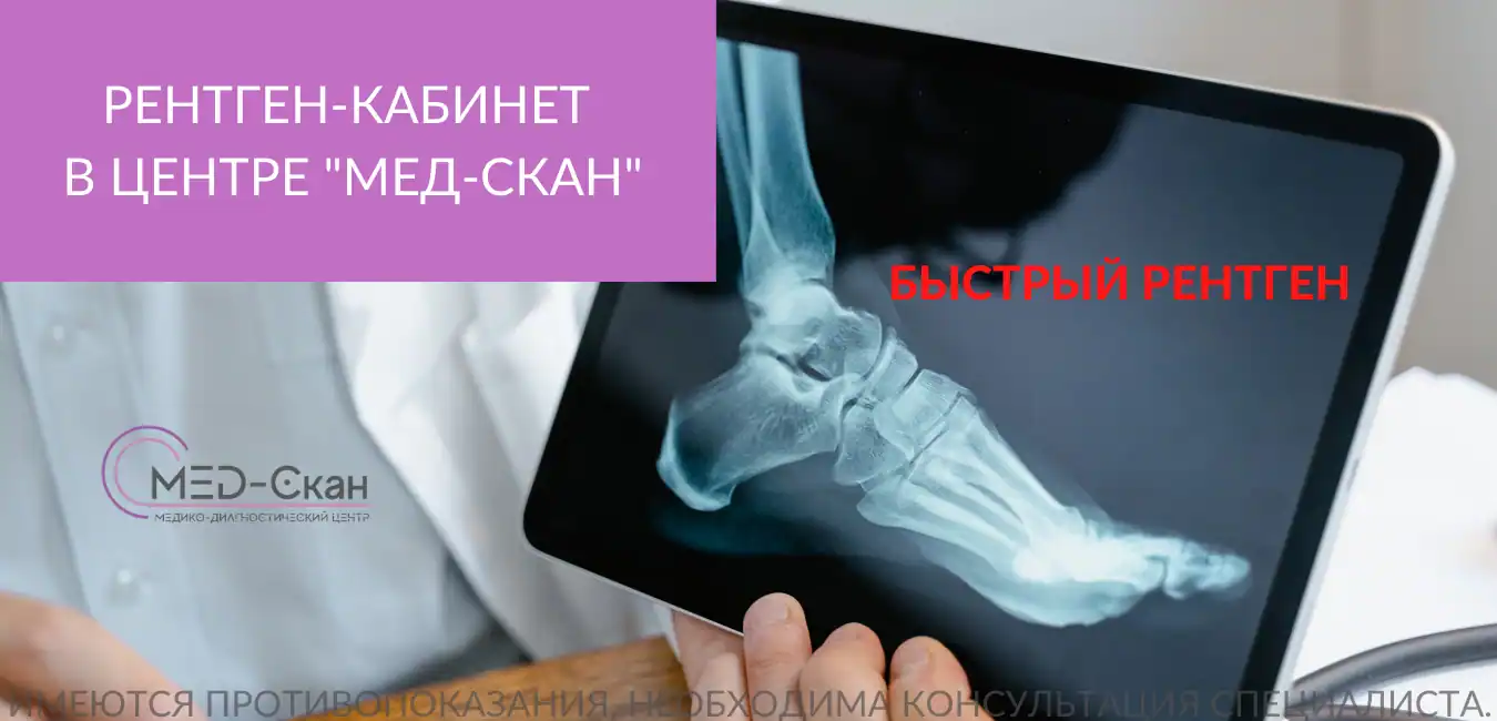 Slide_4