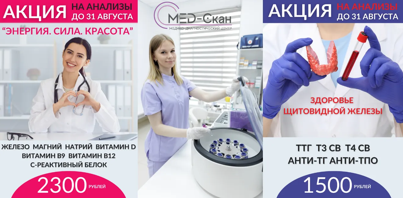 Акция на анализы до 31 августа в Мед-Скан от 1500 рублей
