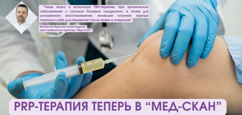 PRP-ТЕРАПИЯ в "Мед-Скан"